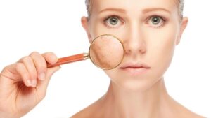 Thức Khuya Ảnh Hưởng Đến Làn Da Như Thế Nào